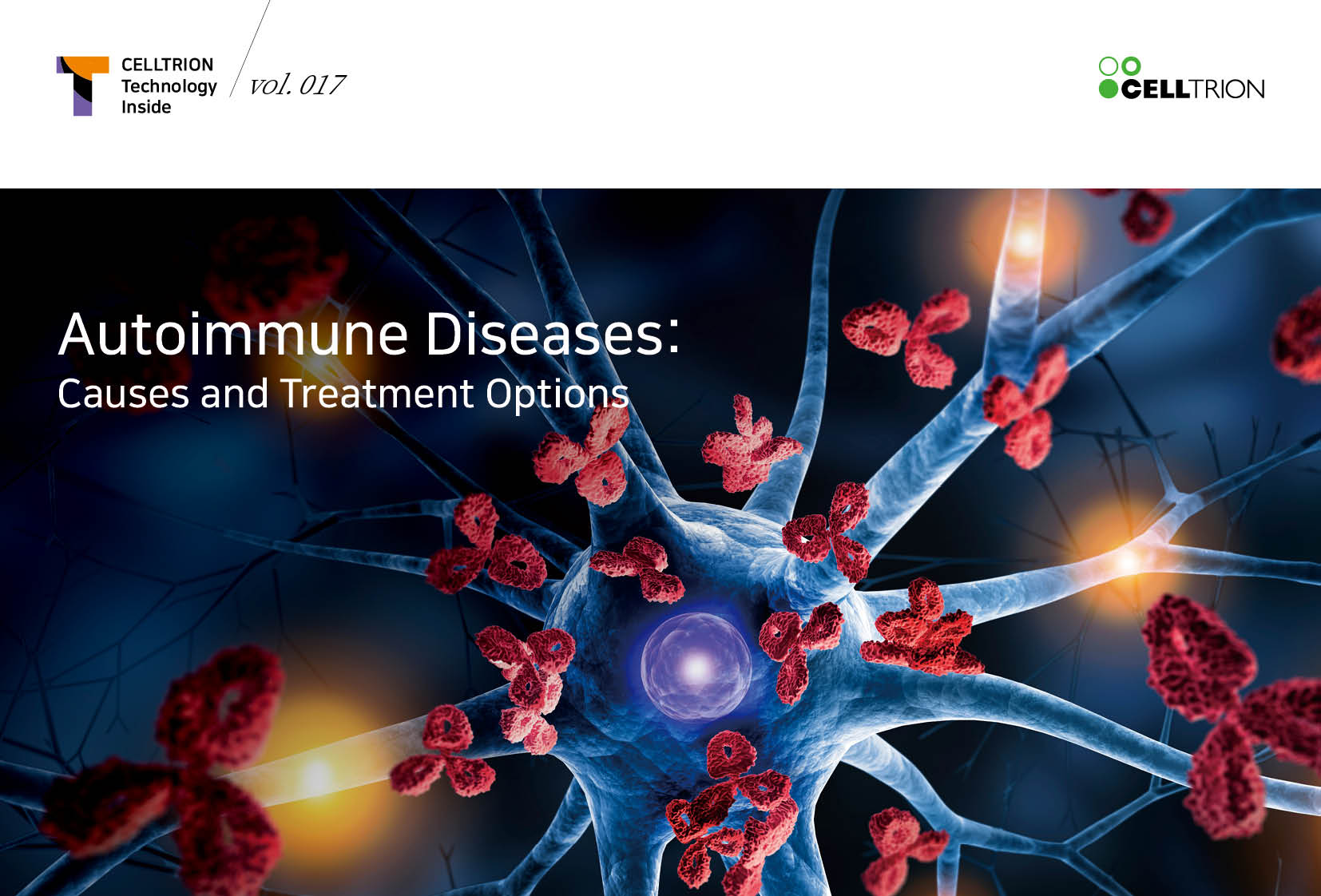 Autoimmune diseases: Causes and treatment options